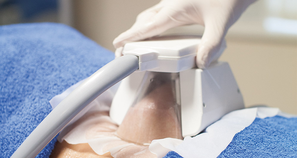 How Fat Freezing and HIFU Work Together? 2 Multiple Areas in One Session HIFU and Fat Freezing Crewe