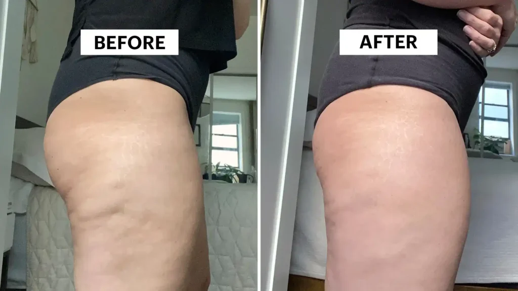 Do Toning Exercise Crewe Really Tackle Cellulite?