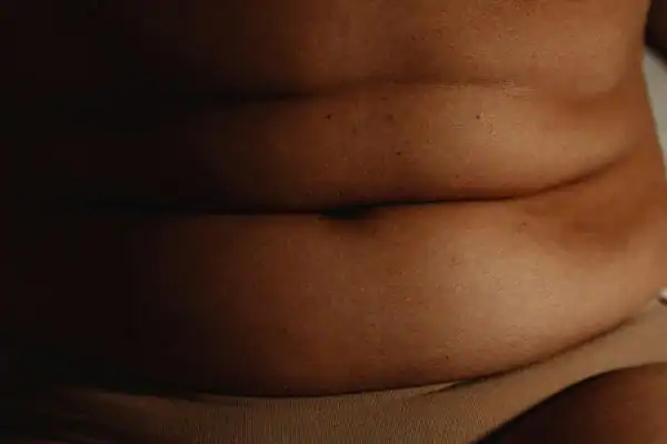 The Hidden Connection: How Stress Shapes Your Fitness and Body Composition 3 image of what stress can do on the stomach area and how Lipo 360 Crewe can help to change your body shape.